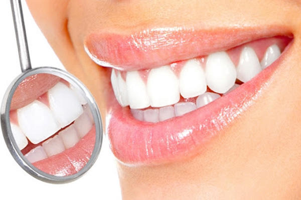 Чим корисна процедура відбілювання зубів?