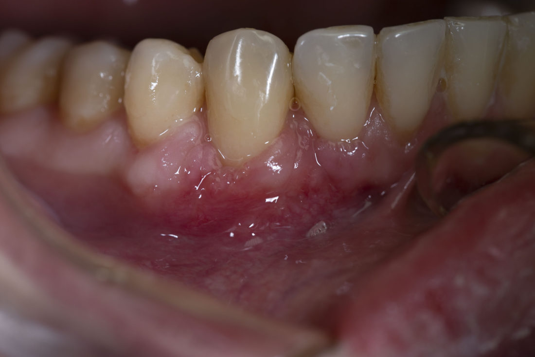 Пародонтологія