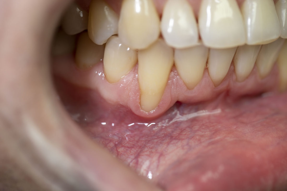 Пародонтологія